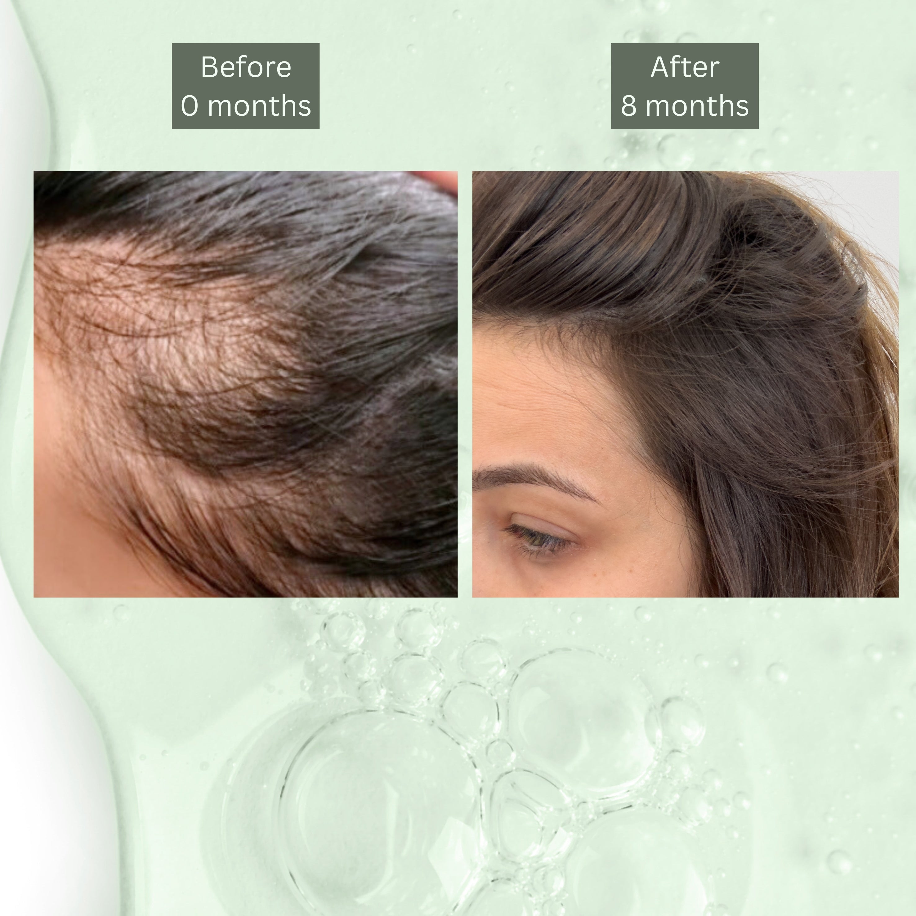 Hi! Hair Scalp Nourishing Serum